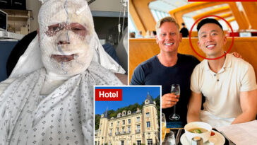 entrepreneur-shows-shocking-photo-after-his-lover-allegedly-attacked-him-in-luxury-french-villa