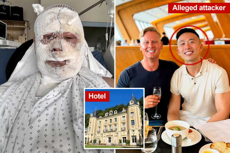 entrepreneur-shows-shocking-photo-after-his-lover-allegedly-attacked-him-in-luxury-french-villa