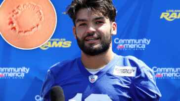 puka-nacua’s-biting-case-takes-another-surprising-turn