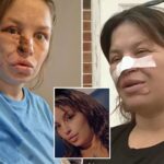 pregnant-woman-needed-‘face-put-back-together’-after-savage-attack-by-neighbor’s-pit-bulls:-‘almost-cost-three-lives’