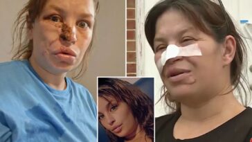 pregnant-woman-needed-‘face-put-back-together’-after-savage-attack-by-neighbor’s-pit-bulls:-‘almost-cost-three-lives’