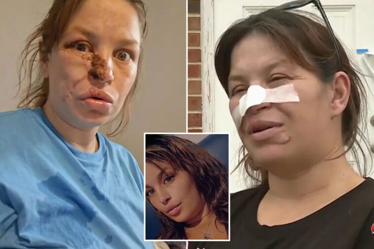 pregnant-woman-needed-‘face-put-back-together’-after-savage-attack-by-neighbor’s-pit-bulls:-‘almost-cost-three-lives’