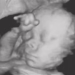 surrogate-baby-saga-takes-dark-new-turn-after-mom-chose-life