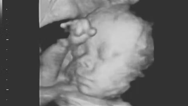 surrogate-baby-saga-takes-dark-new-turn-after-mom-chose-life