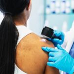 cancer-vaccine-prevents-deadly-melanoma-from-returning-or-spreading-in-landmark-trial