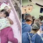 conjoined-twin-girls,-2,-die-in-desperate-surgical-operation-minutes-after-being-separated
