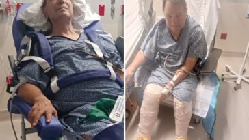 arizona-grandfather-set-to-have-both-legs-amputated-after-tripping-on-scorching-sidewalk-that-burned-his-body