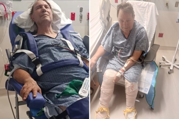 arizona-grandfather-set-to-have-both-legs-amputated-after-tripping-on-scorching-sidewalk-that-burned-his-body