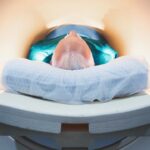 major-brain-changes-that-occur-around-age-50-could-impact-dementia-risk