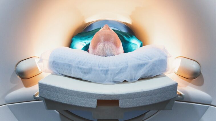 major-brain-changes-that-occur-around-age-50-could-impact-dementia-risk