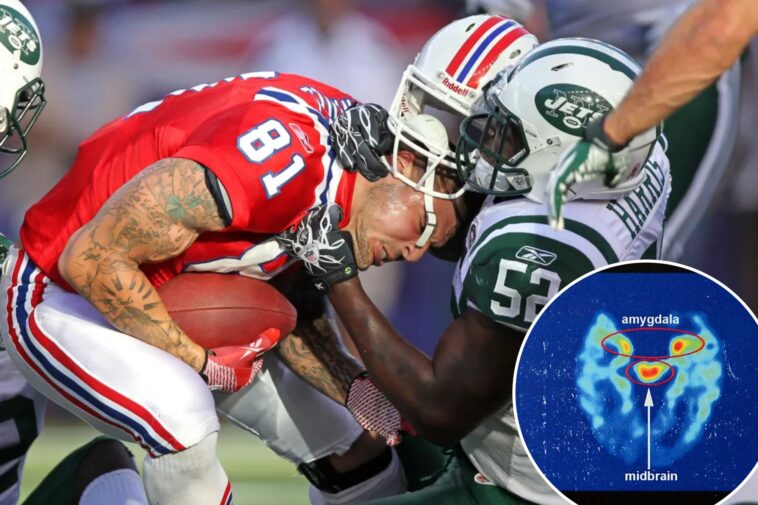 ‘alarmingly-high’-number-of-former-nfl-stars-develop-cte,-according-to-massive-new-study