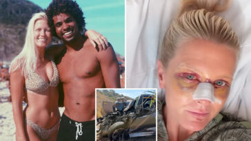 top-surfer-and-his-wife-show-their-horrific-injuries-after-being-mangled-in-california-crash