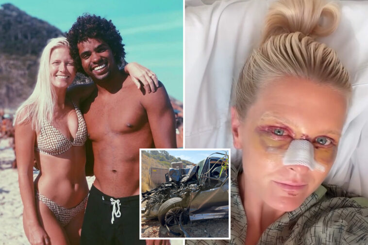 top-surfer-and-his-wife-show-their-horrific-injuries-after-being-mangled-in-california-crash