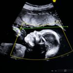 baby-fights-for-life-as-genetic-parents-battle-surrogate-who-refused-abortion