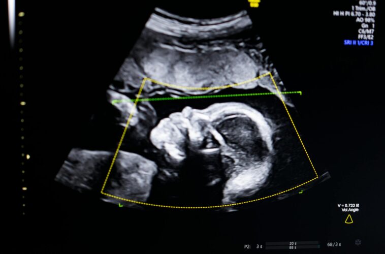 baby-fights-for-life-as-genetic-parents-battle-surrogate-who-refused-abortion