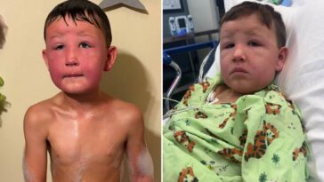 illinois-boy,-7,-nearly-dies-after-touching-poisonous-weeds-in-his-backyard:-‘i-couldn’t-breathe’