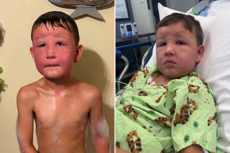 illinois-boy,-7,-nearly-dies-after-touching-poisonous-weeds-in-his-backyard:-‘i-couldn’t-breathe’