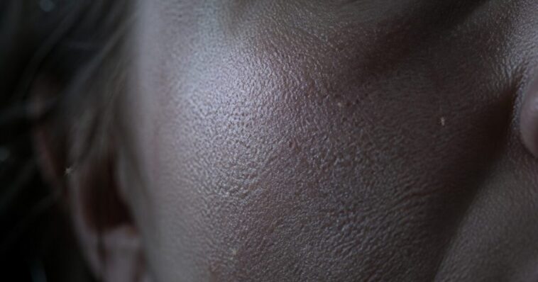 crazy-as-it-sounds,-there-are-probably-microscopic-mites-in-your-face-pores-that-come-out-at-night