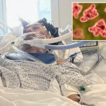 north-carolina-teen-dies-from-rare-brain-eating-amoeba-typically-linked-to-freshwater-swimming