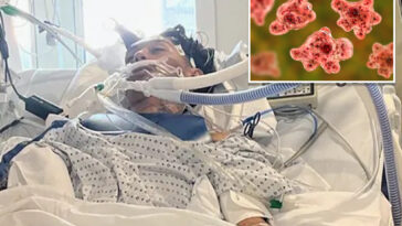 north-carolina-teen-dies-from-rare-brain-eating-amoeba-typically-linked-to-freshwater-swimming