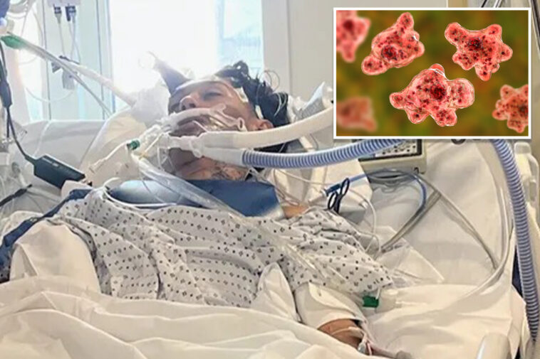 north-carolina-teen-dies-from-rare-brain-eating-amoeba-typically-linked-to-freshwater-swimming