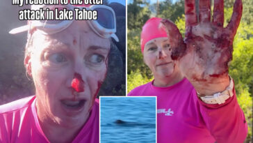swimmer-mauled-in-vicious-attack-by-‘ruthless’-river-otter:-‘it-just-kept-coming’