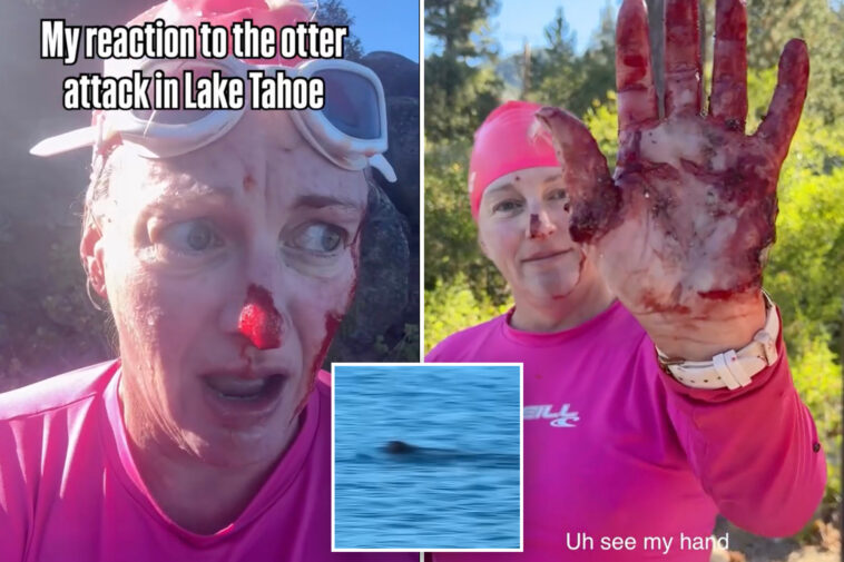 swimmer-mauled-in-vicious-attack-by-‘ruthless’-river-otter:-‘it-just-kept-coming’