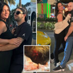olympic-hockey-star-smacked-in-head-so-hard-by-a-puck-he-can-no-longer-have-sex-with-his-wife:-suit