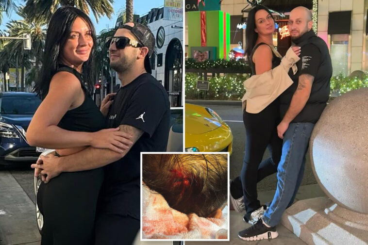 olympic-hockey-star-smacked-in-head-so-hard-by-a-puck-he-can-no-longer-have-sex-with-his-wife:-suit