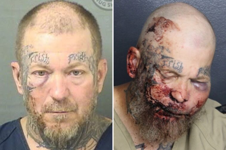 florida-man-left-with-swollen-face-in-mugshot-after-attacking-cop-inside-hospital:-‘i-want-to-fight-you’