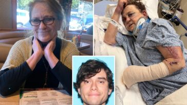grandmother-who-opened-home-to-stranger-beaten-within-inch-of-her-life-in-brutal-baseball-bat-assault
