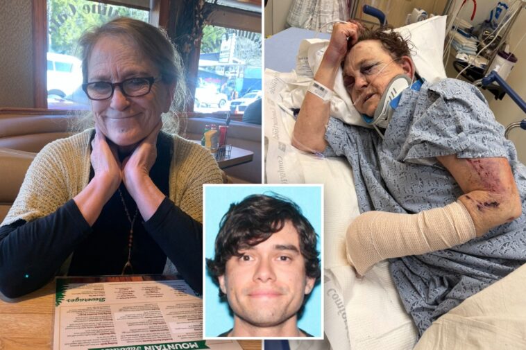 grandmother-who-opened-home-to-stranger-beaten-within-inch-of-her-life-in-brutal-baseball-bat-assault