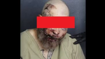 whoa:-florida-man’s-mugshot-after-he-allegedly-tried-to-fight-cop-tells-the-story-itself