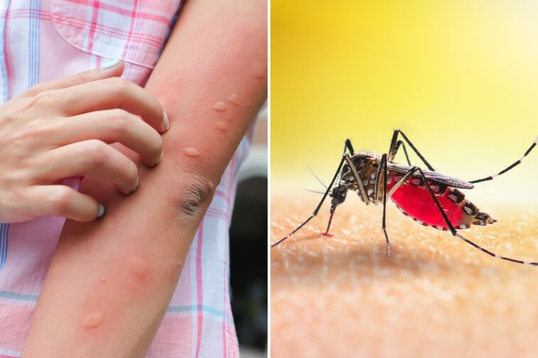 dangerous-mosquito-borne-virus-spreads-in-florida-as-officials-warn-of-rising-cases
