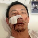 australian-man-hospitalized-after-brutal-home-invasion,-sword-attack-allegedly-carried-out-by-2-teens