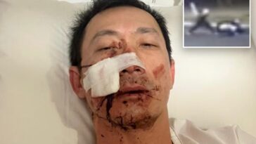 australian-man-hospitalized-after-brutal-home-invasion,-sword-attack-allegedly-carried-out-by-2-teens