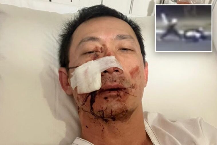 australian-man-hospitalized-after-brutal-home-invasion,-sword-attack-allegedly-carried-out-by-2-teens