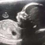 the-thing-america-lost-before-it-stopped-having-babies
