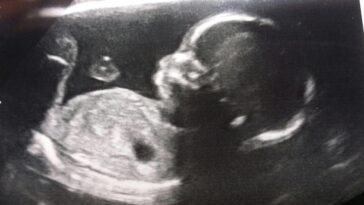 the-thing-america-lost-before-it-stopped-having-babies