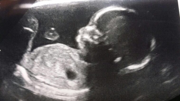 the-thing-america-lost-before-it-stopped-having-babies