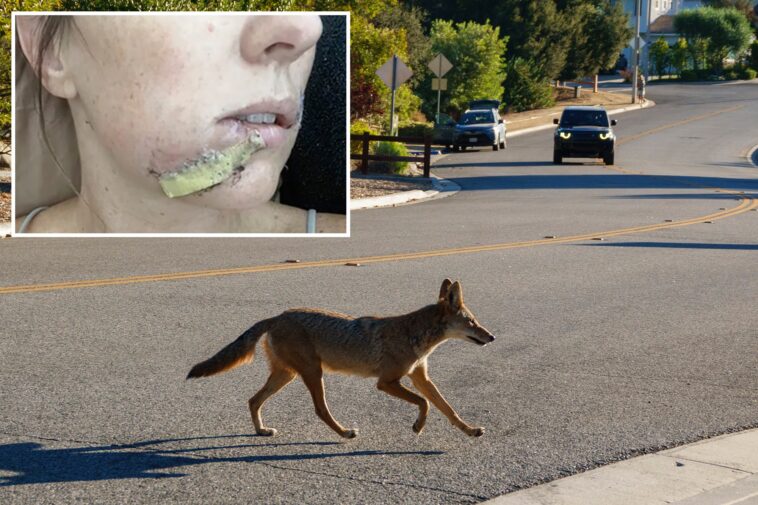 arizona-mom-fights-off-crazed-coyote-with-flip-flip-after-wild-animal-attacks-4-year-old-daughter