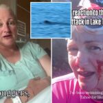 lake-tahoe-swimmer-attacked-by-‘ruthless’-otter-undergoes-surgery
