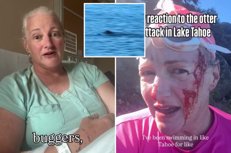 lake-tahoe-swimmer-attacked-by-‘ruthless’-otter-undergoes-surgery