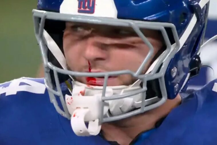 giants’-cam-skattebo-fumes-after-being-left-bloodied-by-controversial-facemask-no-call