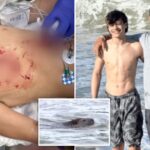 boy,-13,-attacked-by-rabid-beaver-at-maryland-state-park-undergoes-multiple-surgeries