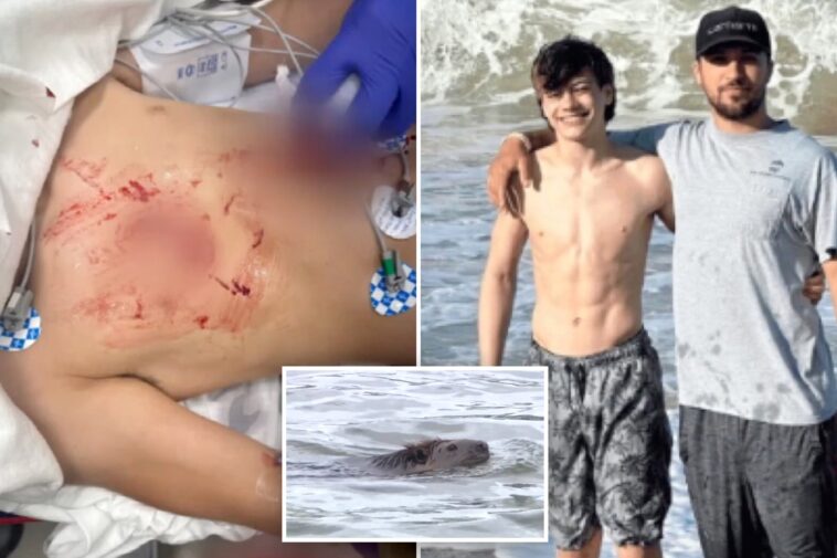 boy,-13,-attacked-by-rabid-beaver-at-maryland-state-park-undergoes-multiple-surgeries
