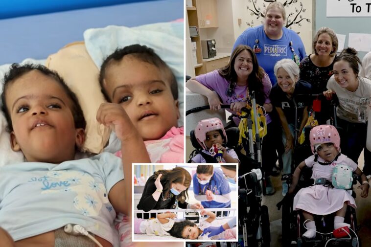 conjoined-twins-attached-at-the-head-successfully-separated-after-procedure-requiring-‘sublime-precision’