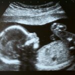 i-read-two-words-about-unborn-babies-that-stopped-me-cold