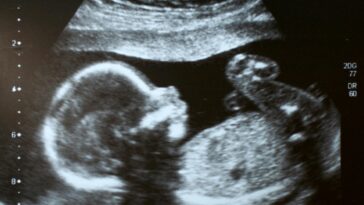 i-read-two-words-about-unborn-babies-that-stopped-me-cold