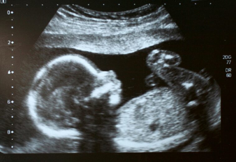 i-read-two-words-about-unborn-babies-that-stopped-me-cold